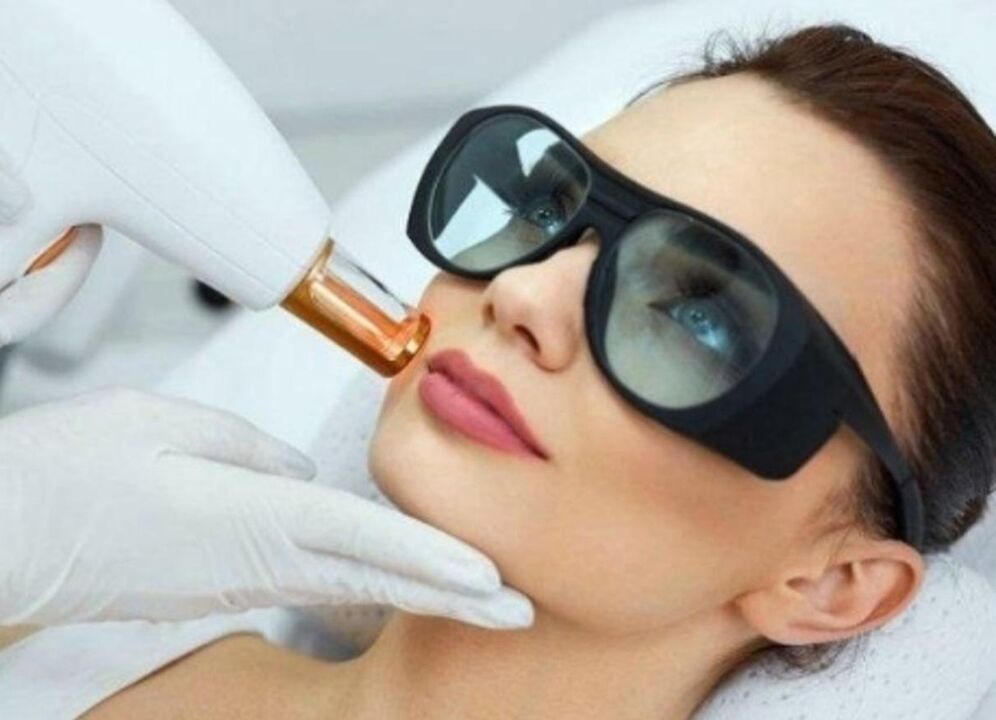 gezicht Verjonging van de huidhuid