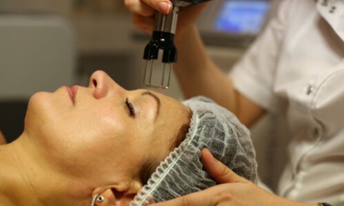 fractionele thermolyse voor verjonging